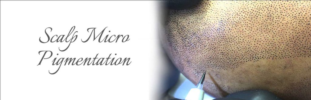 scalp micro pigmentation